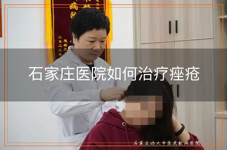 石家庄医院如何治疗痤疮