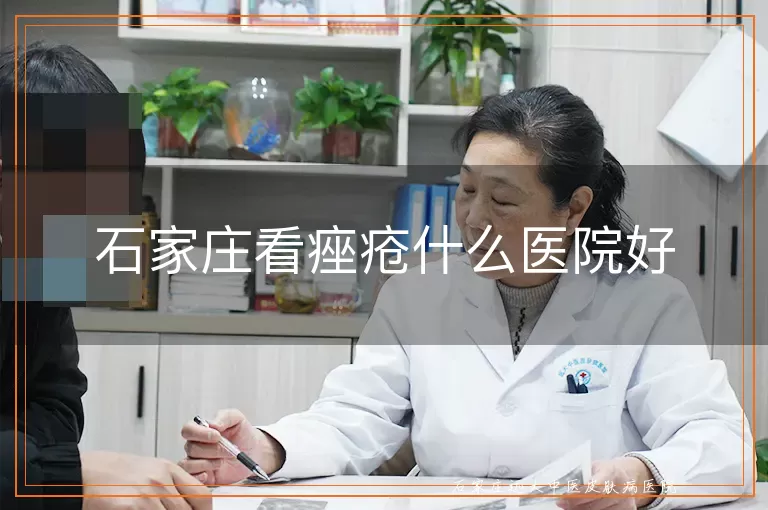 石家庄看痤疮什么医院好