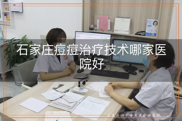 石家庄痘痘治疗技术哪家医院好