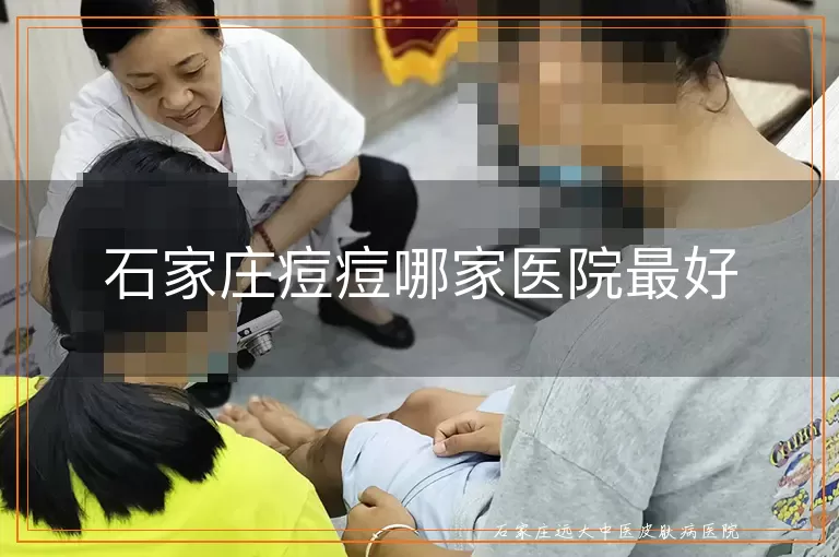 石家庄痘痘哪家医院最好