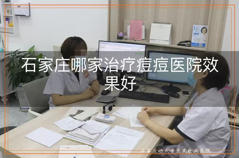 石家庄哪家治疗痘痘医院效果好