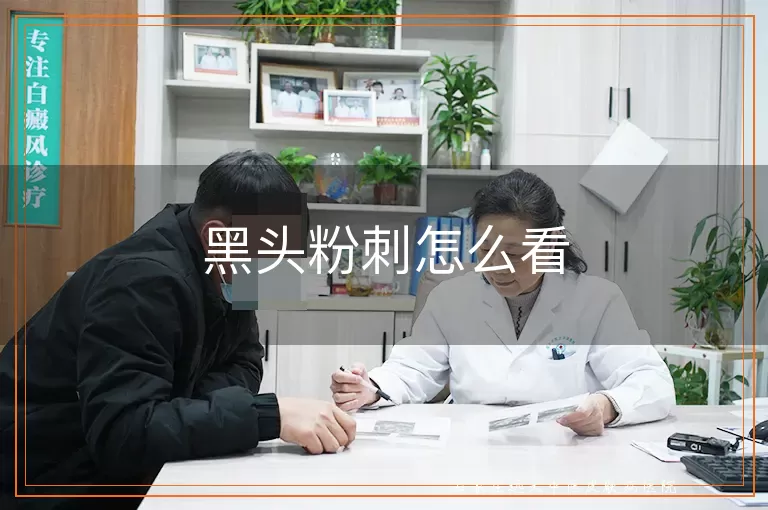 黑头粉刺怎么看