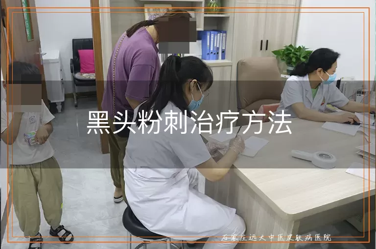 黑头粉刺治疗方法