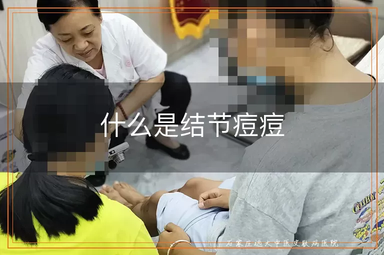 什么是结节痘痘